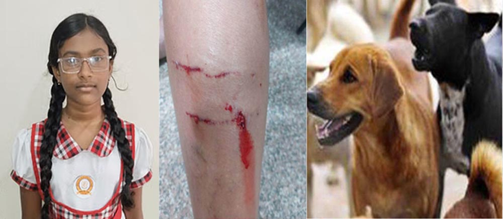 Dog Attack: स्कूल जा रही छात्रा को चलती गाड़ी से कुत्ते ने खींचा… काटा भी; पिता कर रहे कार्रवाई की मांग