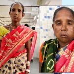 रायपुर: संजीवनी बना मेगा सुपर स्पेशलिटी हेल्थ कैंप, बुधरी मड़कम को मिला नया जीवन